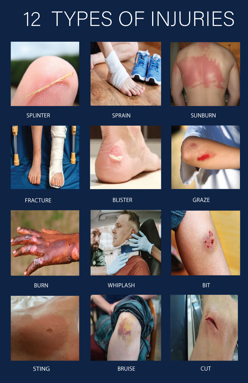 What Are Examples Of Mild Injuries